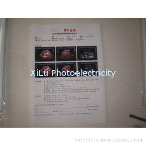 Semi Transparent Rigid PET Laser Printing Medical Image Fil